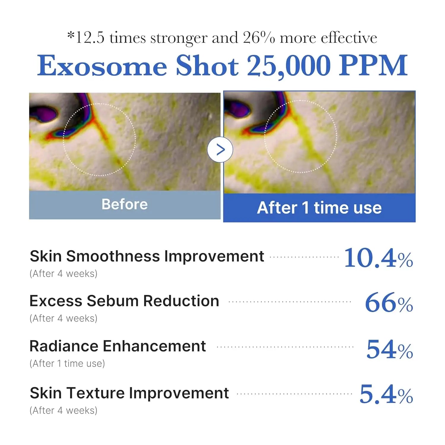 MEDICUBE Zero Exome Shot Spicule (25,000 PPM) Skin Booster Facial Serum