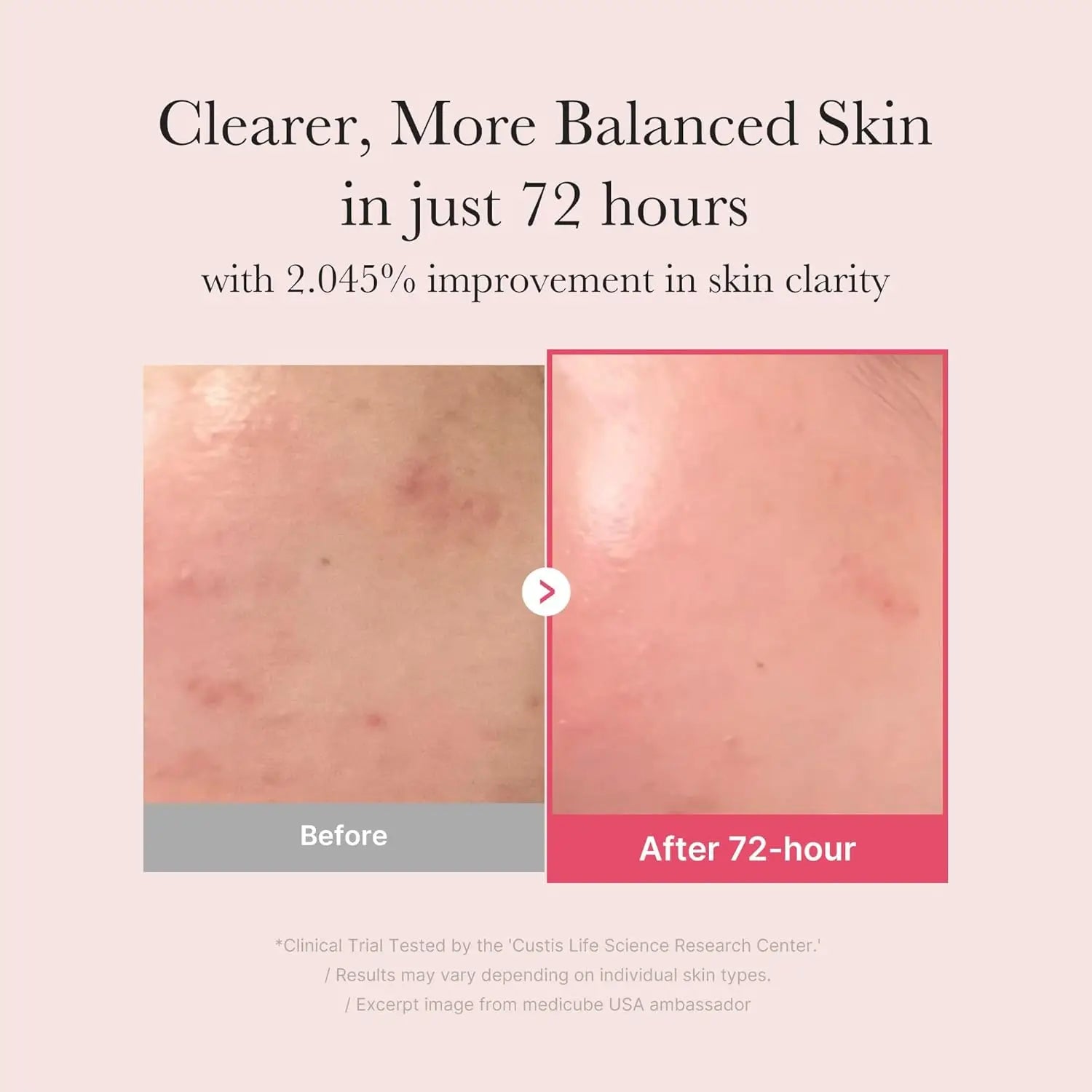 MEDICUBE TXA + Niacinamide Glow Facial Serum