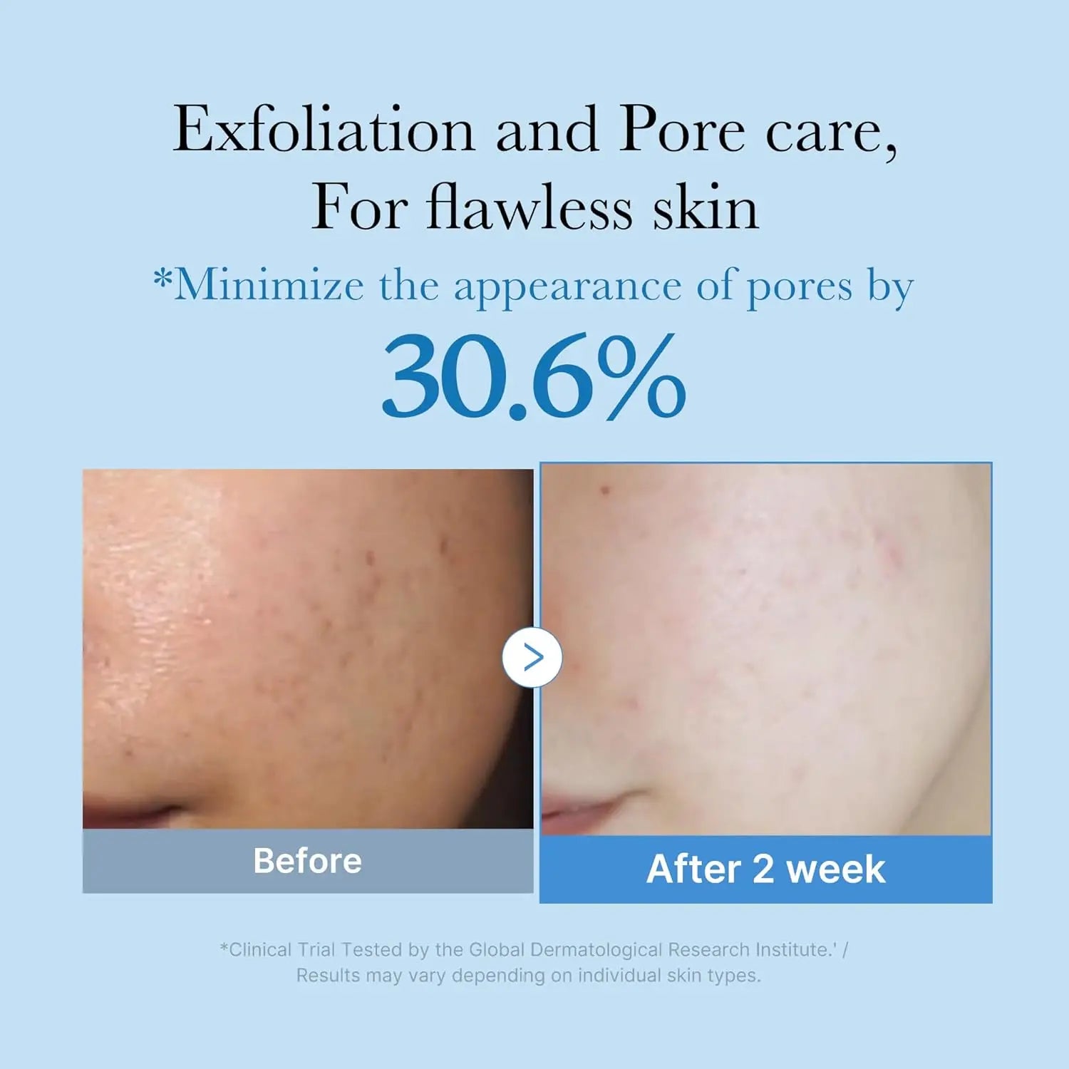 MEDICUBE Zero Pore Exfoliating Hydrating Toner