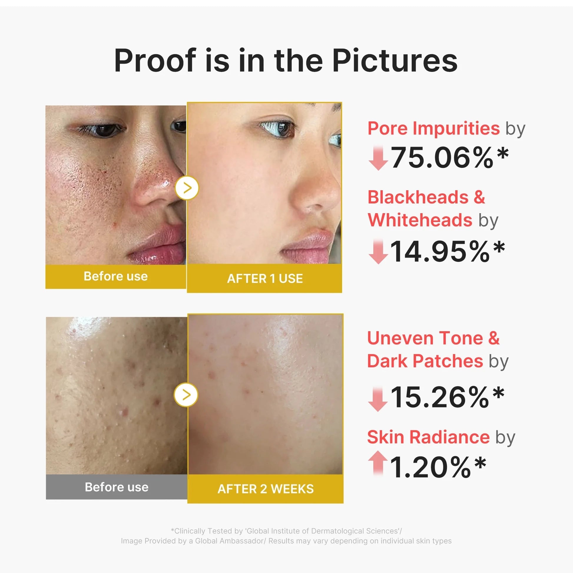 MEDICUBE Kojic Acid Turmeric Exfoliating Face Peel Shot