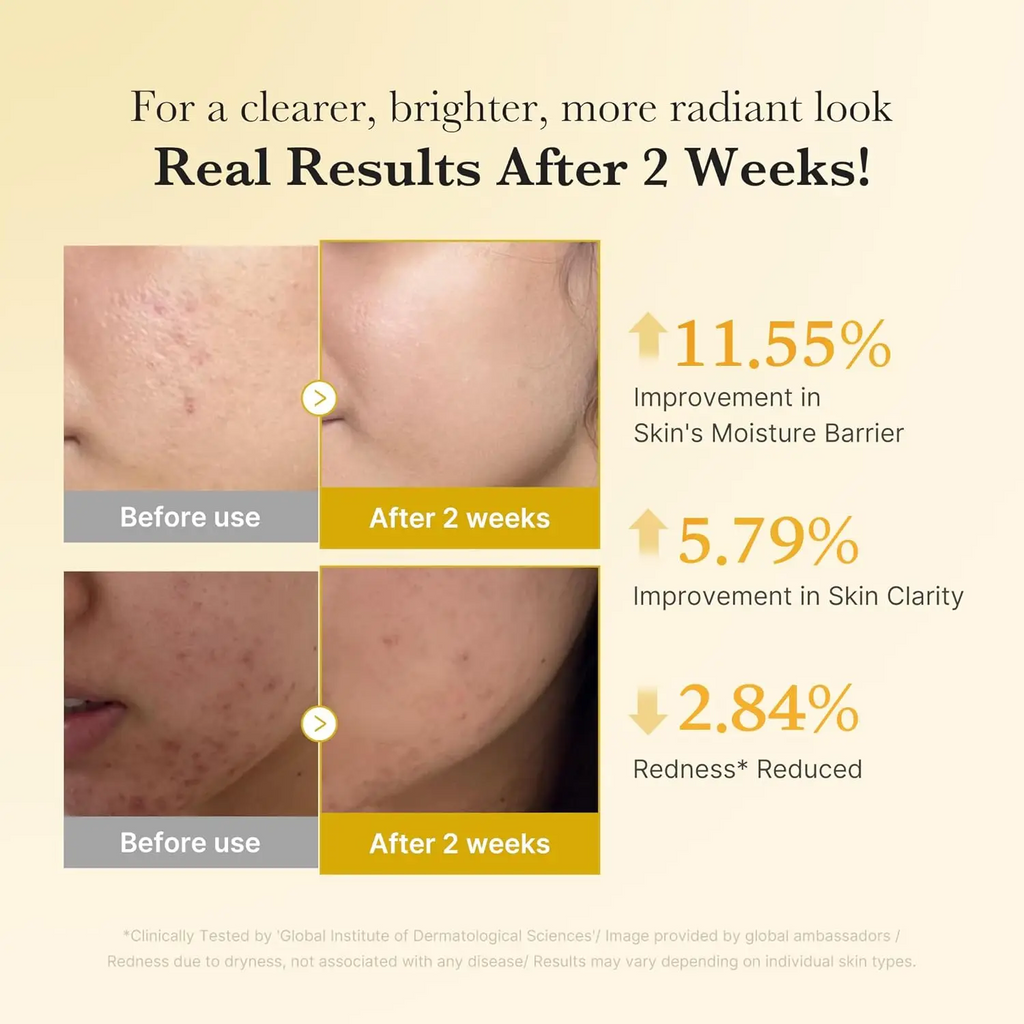 MEDICUBE Kojic Acid Turmeric Radiant Glow Repair Serum
