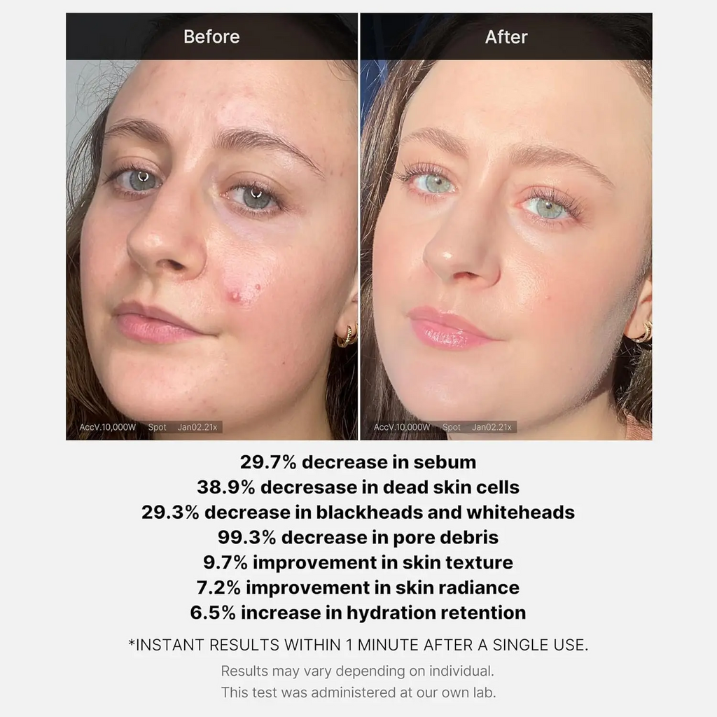 MEDICUBE Red Succinic Acid Exfoliant Peel Serum