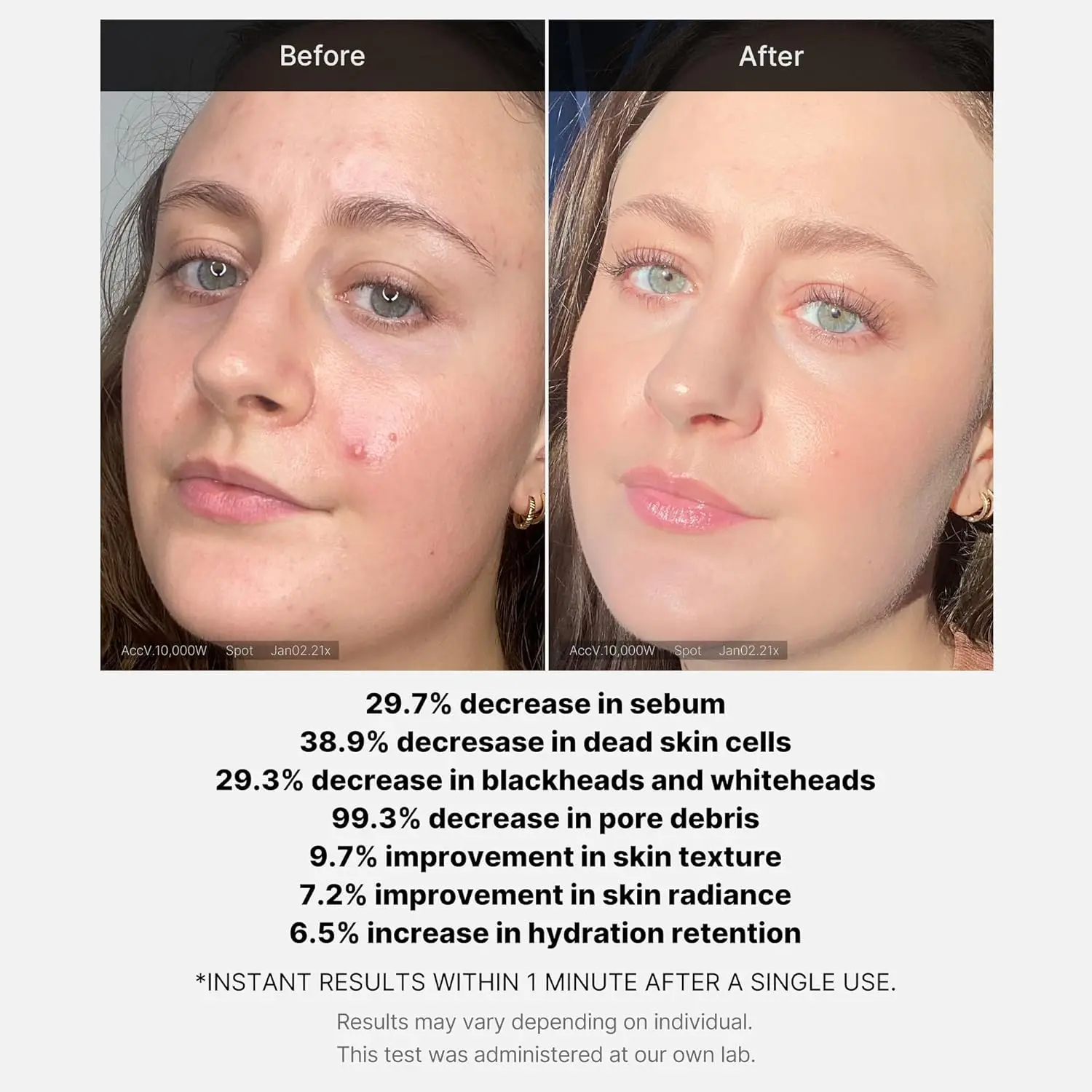 MEDICUBE Red Succinic Acid Exfoliant Peel Serum