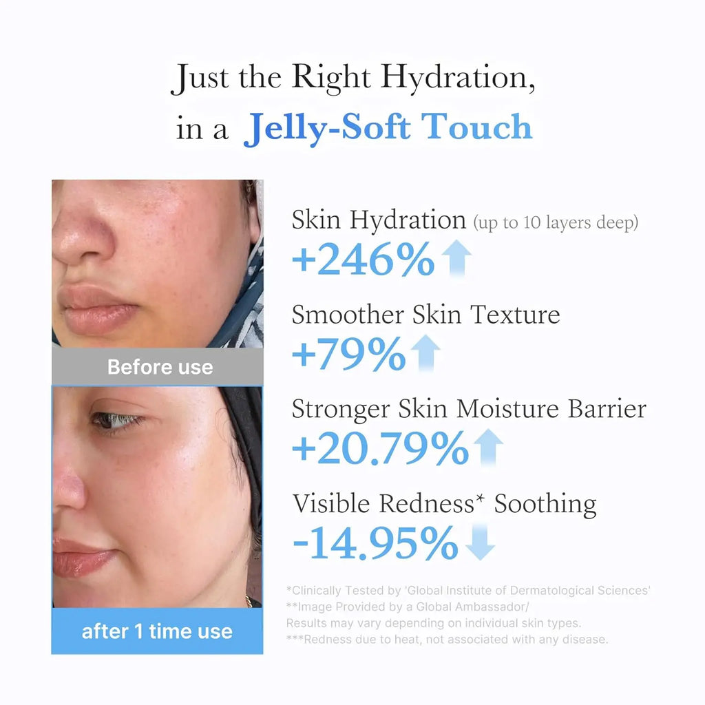 MEDICUBE Hyaluronic Acid Jelly Cream