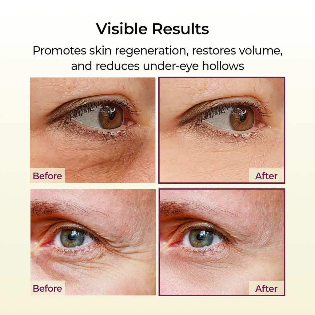 Dr. Melaxin Cemenrete Calcium Radiant Eye Cream