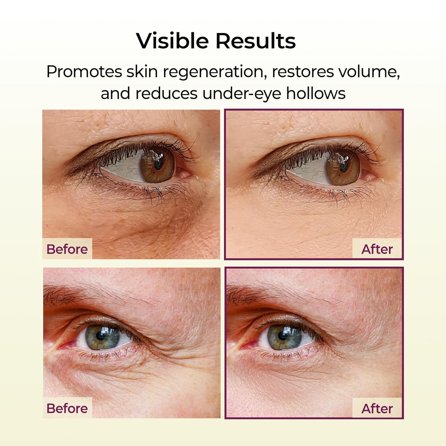Dr. Melaxin Cemenrete Calcium Radiant Eye Cream
