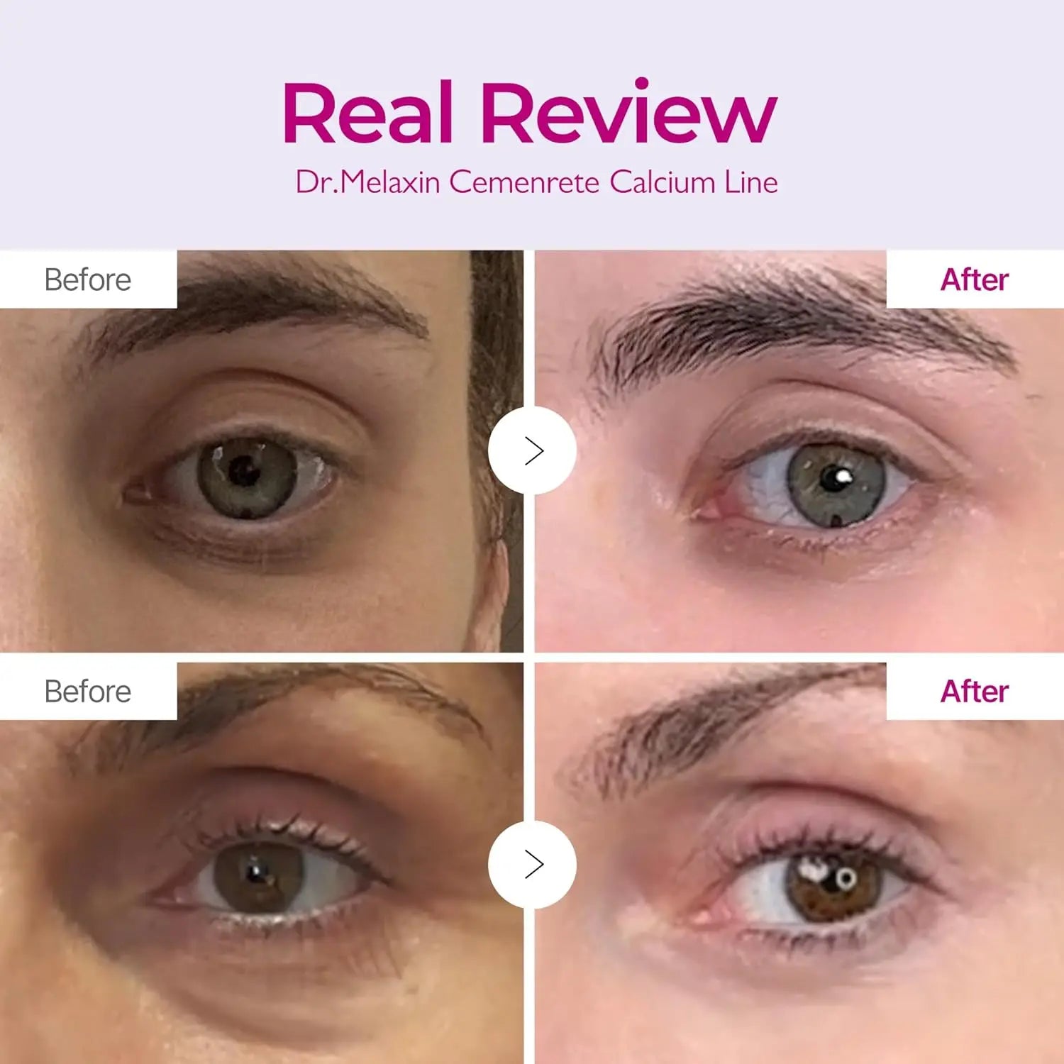 Dr. Melaxin Cemenrete Calcium Lift Firming Cream